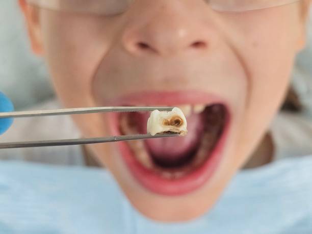 Best Emergency Care for Gum Disease in Unalaska, AK